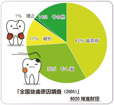 全国抜歯原因調査