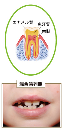 歯の構造と混合歯列期の歯の状態