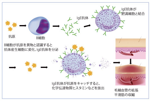 アレルギーが起こるしくみ