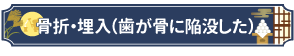 骨折・埋入（歯が骨に陥没した）