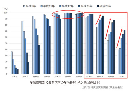 年齢階級別う蝕有病率の年次推移