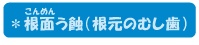 根面う蝕（根元のむし歯）